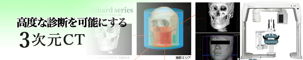 矯正治療,CT診断